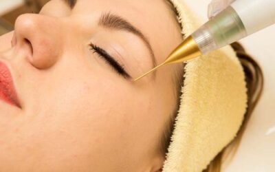 Senac promove workshop sobre técnicas de rejuvenescimento com o Jato Plasma